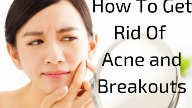 how-to-get-rid-of-acne-and-breakouts