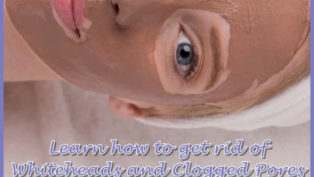 how-to-get-rid-of-whiteheads-and-clogged-pores