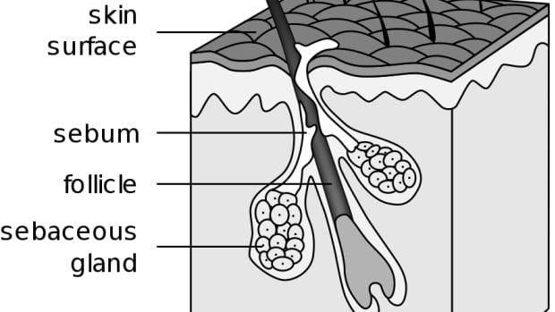 how-to-reduce-the-odds-of-getting-pimples-in-a-cheap-way